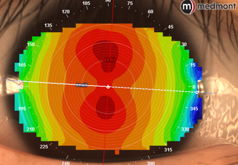 Baseline topography