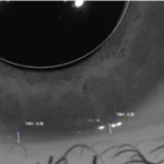 Tear Meniscus Height Measurement