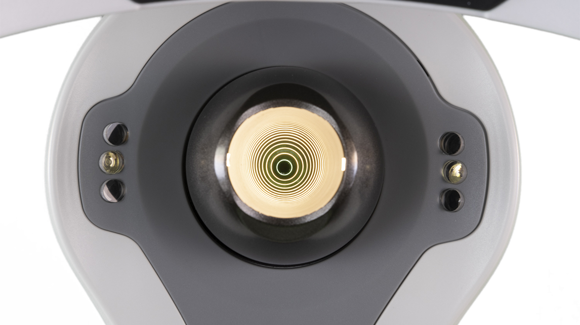 Why Cone Size Matters in Placido Ring Topographers